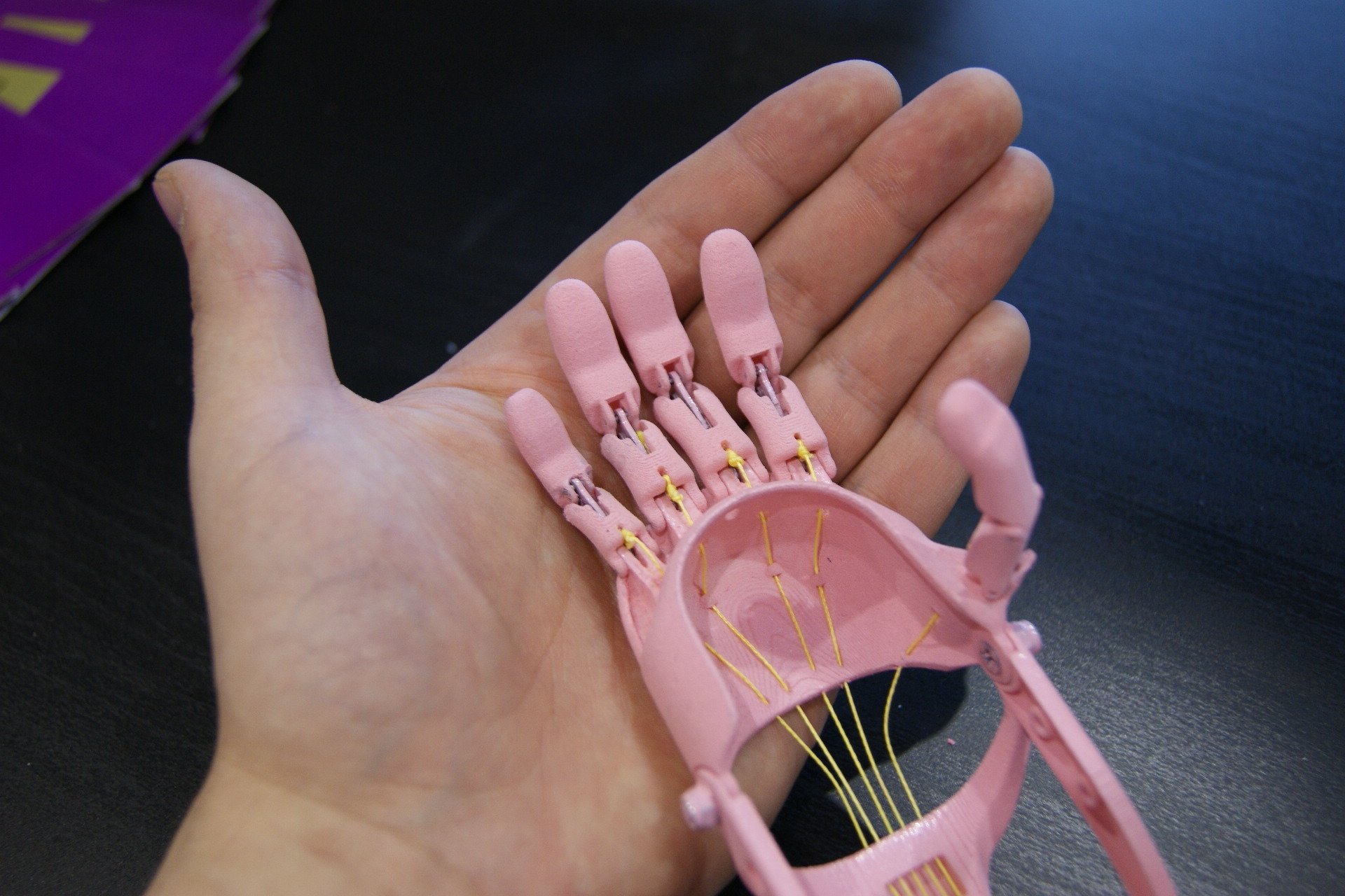 В России сделан первый 3D-протез смотреть